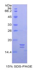 SDS-PAGE (GP1BA-1832H).jpg